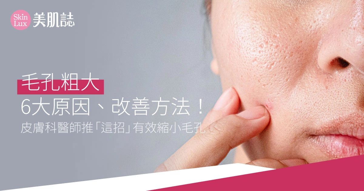 毛孔粗大6大原因、改善方法!皮膚科醫師推「這招」有效縮小毛孔