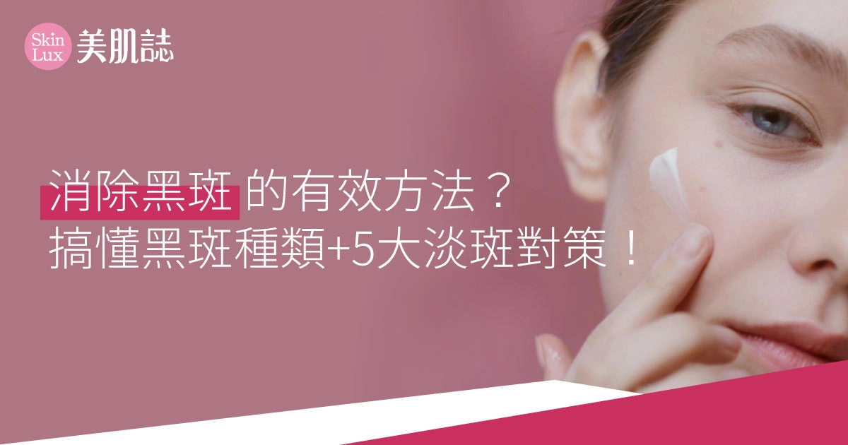 消除黑斑的有效方法？搞懂黑斑種類 + 5大淡斑對策全攻略！