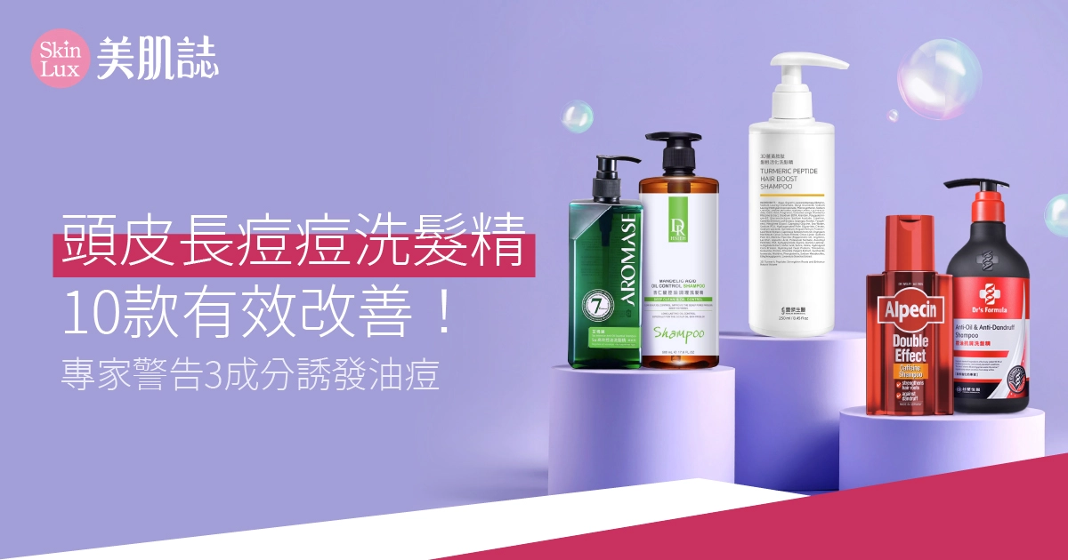 【2026頭皮長痘痘洗髮精】10款有效改善！專家警告3成分誘發油痘